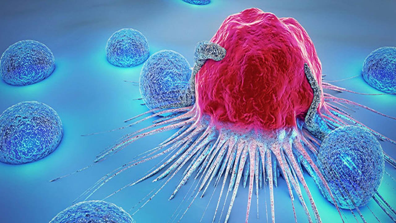 Cancer | స్టేజ్-1 లో గుర్తిస్తే క్యాన్సర్ను జయించడం తేలిక.. ఈ లక్షణాలు ఉన్నాయా..!